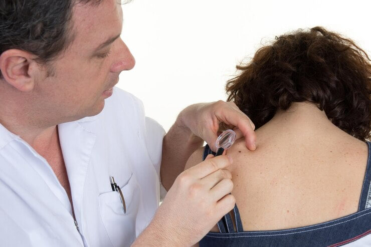 Câncer de pele pela Medicina Germânica Heilkunde