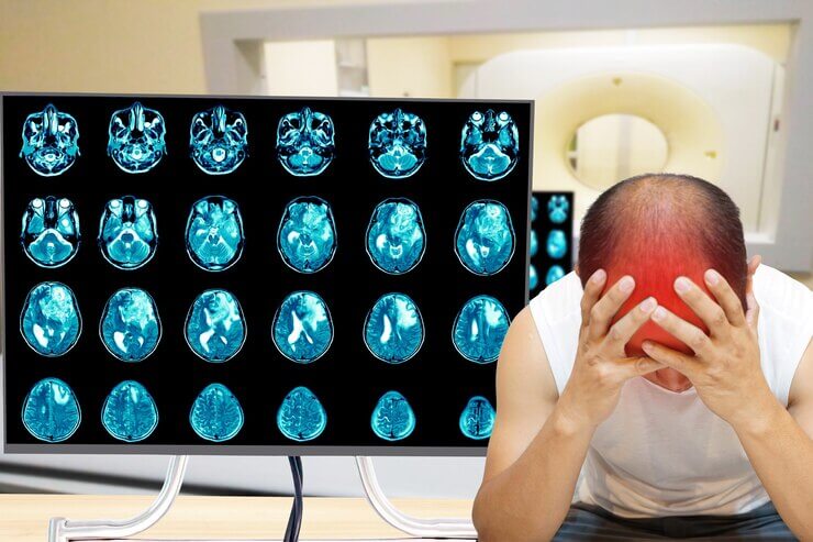 O que é afasia? Pela Medicina Germânica Heilkunde