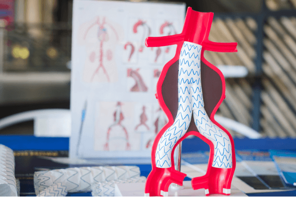 Aneurisma pela Medicina Germânica Heilkunde